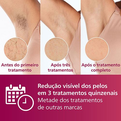 Depiladora de Luz Pulsada Philips Lumea IPL Série 7000 SC1997/00 - Image 2